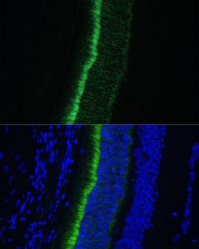 GNGT1 Antibody - Immunofluorescence analysis of Mouse eye using GNGT1 Polyclonal Antibody at dilution of 1:100 (40x lens).Blue: DAPI for nuclear staining.
