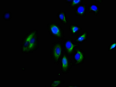 GNGT2 Antibody - Immunofluorescence staining of A549 cells with GNGT2 Antibody at 1:200, counter-stained with DAPI. The cells were fixed in 4% formaldehyde, permeabilized using 0.2% Triton X-100 and blocked in 10% normal Goat Serum. The cells were then incubated with the antibody overnight at 4°C. The secondary antibody was Alexa Fluor 488-congugated AffiniPure Goat Anti-Rabbit IgG(H+L).