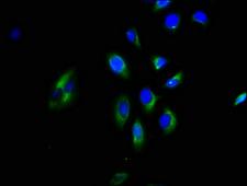 GNGT2 Antibody - Immunofluorescence staining of A549 cells with GNGT2 Antibody at 1:200, counter-stained with DAPI. The cells were fixed in 4% formaldehyde, permeabilized using 0.2% Triton X-100 and blocked in 10% normal Goat Serum. The cells were then incubated with the antibody overnight at 4°C. The secondary antibody was Alexa Fluor 488-congugated AffiniPure Goat Anti-Rabbit IgG(H+L).