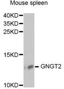 GNGT2 Antibody - Western blot analysis of extracts of mouse spleen, using GNGT2 antibody at 1:1000 dilution. The secondary antibody used was an HRP Goat Anti-Rabbit IgG (H+L) at 1:10000 dilution. Lysates were loaded 25ug per lane and 3% nonfat dry milk in TBST was used for blocking. An ECL Kit was used for detection and the exposure time was 90s.