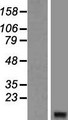 GNGT2 Protein - Western validation with an anti-DDK antibody * L: Control HEK293 lysate R: Over-expression lysate