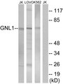 GNL1 Antibody - Western blot analysis of lysates from Jurkat, LOVO, and K562 cells, using GNL1 Antibody. The lane on the right is blocked with the synthesized peptide.