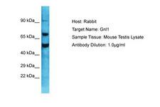 GNL1 Antibody -  This image was taken for the unconjugated form of this product. Other forms have not been tested.