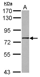 GNL1 Antibody - Sample (30 ug of whole cell lysate) A: A431 7.5% SDS PAGE GNL1 antibody diluted at 1:1000