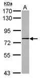 GNL1 Antibody - Sample (30 ug of whole cell lysate) A: A431 7.5% SDS PAGE GNL1 antibody diluted at 1:1000