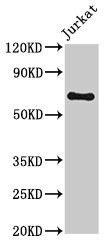 GNL1 Antibody - Western Blot Positive WB detected in: Jurkat whole cell lysate All lanes: GNL1 antibody at 3.2µg/ml Secondary Goat polyclonal to rabbit IgG at 1/50000 dilution Predicted band size: 69, 48 kDa Observed band size: 69 kDa