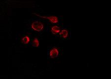GNL1 Antibody - Staining HeLa cells by IF/ICC. The samples were fixed with PFA and permeabilized in 0.1% Triton X-100, then blocked in 10% serum for 45 min at 25°C. The primary antibody was diluted at 1:200 and incubated with the sample for 1 hour at 37°C. An Alexa Fluor 594 conjugated goat anti-rabbit IgG (H+L) Ab, diluted at 1/600, was used as the secondary antibody.
