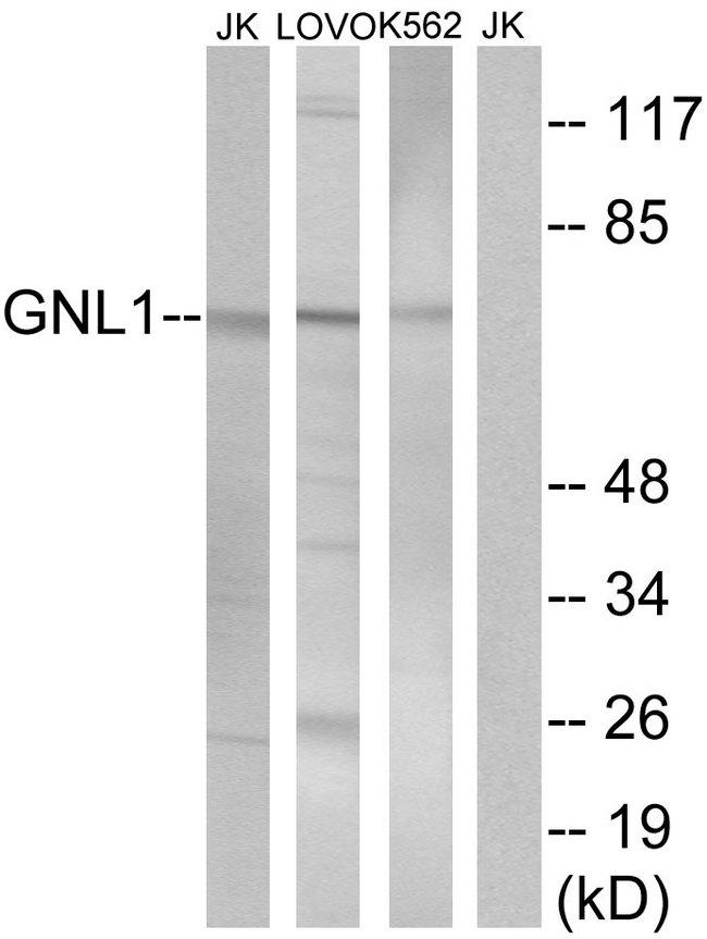 GNL1 Antibody - Western blot analysis of extracts from Jurkat cells, LOVO cells and K562 cells, using GNL1 antibody.