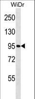 GNL2 Antibody - GNL2 Antibody western blot of WiDr cell line lysates (35 ug/lane). The GNL2 antibody detected the GNL2 protein (arrow).