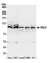 GNL2 Antibody - Detection of human and mouse GNL2 by western blot. Samples: Whole cell lysate (15 µg) from HeLa, HEK293T, Jurkat, mouse TCMK-1, and mouse NIH 3T3 cells prepared using NETN lysis buffer. Antibody: Affinity purified rabbit anti-GNL2 antibody used for WB at 0.1 µg/ml. Detection: Chemiluminescence with an exposure time of 10 seconds.