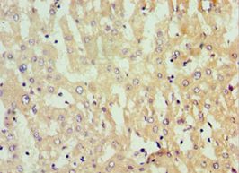 GNL3 / NS / Nucleostemin Antibody - Immunohistochemistry of paraffin-embedded human liver using antibody at 1:100 dilution.