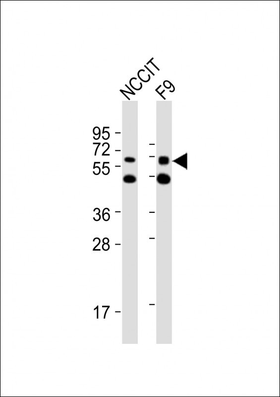 GNL3 / NS / Nucleostemin Antibody - All lanes : Anti-Gnl3 Antibody at 1:2000 dilution Lane 1: NCCIT whole cell lysates Lane 2: F9 whole cell lysates Lysates/proteins at 20 ug per lane. Secondary Goat Anti-Rabbit IgG, (H+L), Peroxidase conjugated at 1/10000 dilution Predicted band size : 61 kDa Blocking/Dilution buffer: 5% NFDM/TBST.
