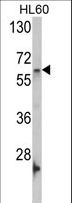 GNL3 / NS / Nucleostemin Antibody - Western blot of GNL3 Antibody in HL60 cell line lysates (35 ug/lane). GNL3 (arrow) was detected using the purified antibody.