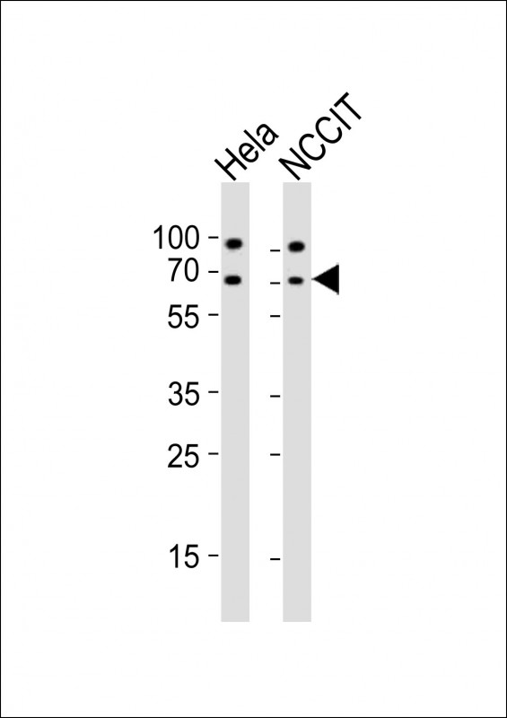 GNL3 / NS / Nucleostemin Antibody - All lanes : Anti-GNL3 Antibody at 1:2000 dilution Lane 1: HeLa whole cell lysates Lane 2: NCCIT whole cell lysates Lysates/proteins at 20 ug per lane. Secondary Goat Anti-Rabbit IgG, (H+L), Peroxidase conjugated at 1/10000 dilution Predicted band size : 62 kDa Blocking/Dilution buffer: 5% NFDM/TBST.