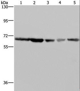GNL3 / NS / Nucleostemin Antibody - Western blot analysis of K562, HeLa, LoVo, 293T and Raji cell, using GNL3 Polyclonal Antibody at dilution of 1:300.
