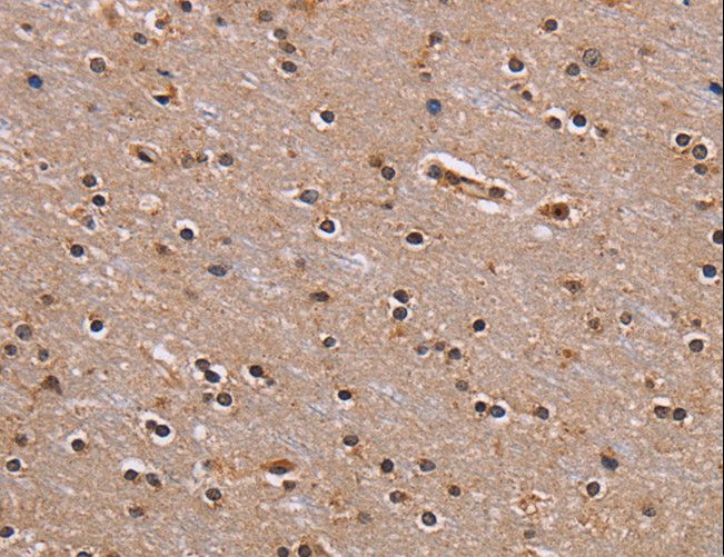 GNL3 / NS / Nucleostemin Antibody - Immunohistochemistry of paraffin-embedded Human brain using GNL3 Polyclonal Antibody at dilution of 1:60.