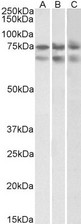 GNL3 / NS / Nucleostemin Antibody - Goat Anti-GNL3 Antibody (2µg/ml) staining of HeLa (A)HepG2 (B) and K562 (C) nuclear lysates (35µg protein in RIPA buffer). Primary incubation was 1 hour. Detected by chemiluminescencence.
