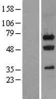 GNL3 / NS / Nucleostemin Protein - Western validation with an anti-DDK antibody * L: Control HEK293 lysate R: Over-expression lysate