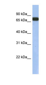 GNL3L Antibody - GNL3L antibody Western blot of Fetal Lung lysate. This image was taken for the unconjugated form of this product. Other forms have not been tested.