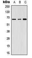 GNL3L Antibody - Western blot analysis of GNL3L expression in Lovo (A); HeLa (B); NIH3T3 (C) whole cell lysates.