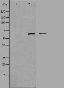 GNL3L Antibody - Western blot analysis of extracts of HeLa cells using GNL3L antibody. The lane on the left is treated with the antigen-specific peptide.