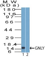 GNLY / Granulysin Antibody - Western Blot: Granulysin Antibody - Analysis of GNLY using HEK293 cell lysate in the 1) absence and 2) presence of immunizing peptide probed with 2 ug/ml of GNLY antibody. Goat anti-rabbit Ig HRP secondary antibody and PicoTect ECL substrate solution were used for this test.
