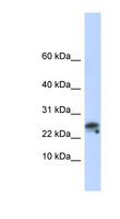 GNLY / Granulysin Antibody - GNLY / Granulysin antibody Western blot of Fetal Muscle lysate. This image was taken for the unconjugated form of this product. Other forms have not been tested.