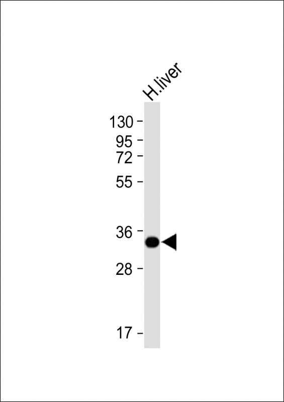 GNMT Antibody - Anti-GNMT Antibody (C-term) at 1:4000 dilution + Human liver lysate Lysates/proteins at 20 µg per lane. Secondary Goat Anti-mouse IgG, (H+L), Peroxidase conjugated at 1/10000 dilution. Predicted band size: 33 kDa Blocking/Dilution buffer: 5% NFDM/TBST.