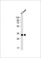 GNMT Antibody - Anti-GNMT Antibody (C-term) at 1:4000 dilution + Human liver lysate Lysates/proteins at 20 µg per lane. Secondary Goat Anti-mouse IgG, (H+L), Peroxidase conjugated at 1/10000 dilution. Predicted band size: 33 kDa Blocking/Dilution buffer: 5% NFDM/TBST.