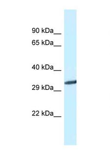 GNMT Antibody - GNMT antibody Western blot of Mouse Liver lysate. Antibody concentration 1 ug/ml.  This image was taken for the unconjugated form of this product. Other forms have not been tested.