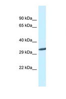GNMT Antibody - GNMT antibody Western blot of Mouse Liver lysate. Antibody concentration 1 ug/ml.  This image was taken for the unconjugated form of this product. Other forms have not been tested.