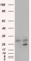 GNMT Antibody - HEK293T cells were transfected with the pCMV6-ENTRY control (Left lane) or pCMV6-ENTRY GNMT (Right lane) cDNA for 48 hrs and lysed. Equivalent amounts of cell lysates (5 ug per lane) were separated by SDS-PAGE and immunoblotted with anti-GNMT.