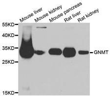 GNMT Antibody - Western blot analysis of extracts of various cell lines.