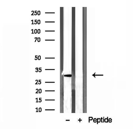 GNMT Antibody - Western blot analysis of extracts of mouse liver tissue using GNMT antibody.