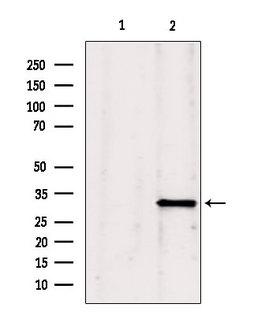 GNMT Antibody - Western blot analysis of extracts of mouse Myeloma cells using GNMT antibody. Lane 1 was treated with the blocking peptide.
