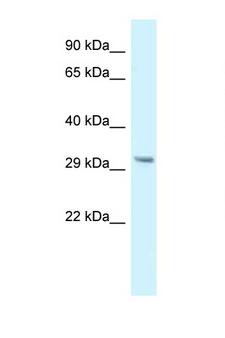 GNMT Antibody - GNMT antibody Western blot of Small Intestine lysate. Antibody concentration 1 ug/ml.  This image was taken for the unconjugated form of this product. Other forms have not been tested.