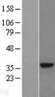 GNMT Protein - Western validation with an anti-DDK antibody * L: Control HEK293 lysate R: Over-expression lysate