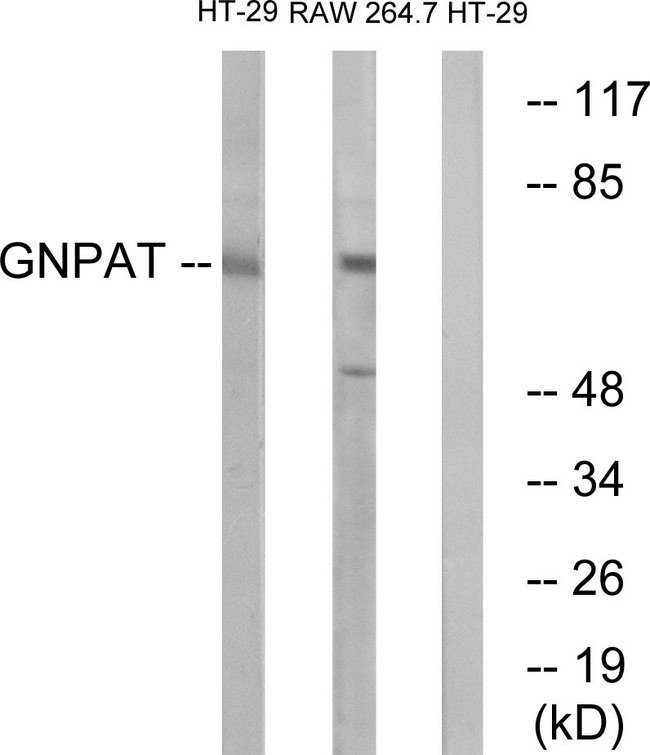 GNPAT / DHAP-AT Antibody - Western blot analysis of lysates from HT-29 and RAW264.7 cells, using GNPAT Antibody. The lane on the right is blocked with the synthesized peptide.