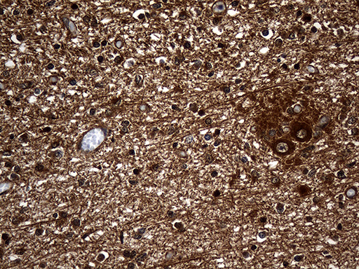 GNPAT / DHAP-AT Antibody - Immunohistochemical staining of paraffin-embedded Human embryonic cerebellum within the normal limits using anti-GNPAT mouse monoclonal antibody. (Heat-induced epitope retrieval by 1mM EDTA in 10mM Tris buffer. (pH8.5) at 120 °C for 3 min. (1:500).