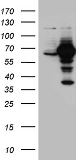 GNPAT / DHAP-AT Antibody - HEK293T cells were transfected with the pCMV6-ENTRY control. (Left lane) or pCMV6-ENTRY GNPAT. (Right lane) cDNA for 48 hrs and lysed. Equivalent amounts of cell lysates. (5 ug per lane) were separated by SDS-PAGE and immunoblotted with anti-GNPAT. (1:2000)