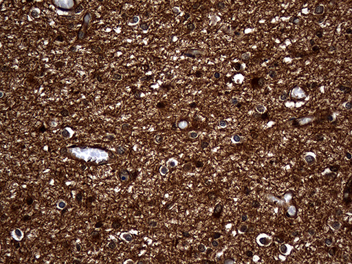 GNPAT / DHAP-AT Antibody - Immunohistochemical staining of paraffin-embedded Human embryonic cerebellum within the normal limits using anti-GNPAT mouse monoclonal antibody. (Heat-induced epitope retrieval by 1mM EDTA in 10mM Tris buffer. (pH8.5) at 120°C for 3 min. (1:500)