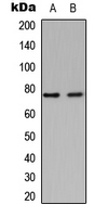 GNPAT / DHAP-AT Antibody - Western blot analysis of DHAPAT expression in HeLa (A); C2C12 (B) whole cell lysates.