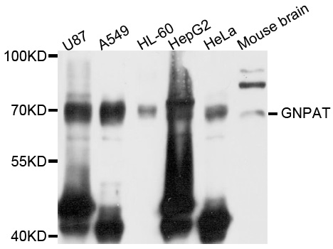 GNPAT / DHAP-AT Antibody - Western blot analysis of extracts of HeLa cells.