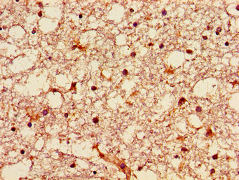 GNPAT / DHAP-AT Antibody - Immunohistochemistry image of paraffin-embedded human brain tissue at a dilution of 1:100