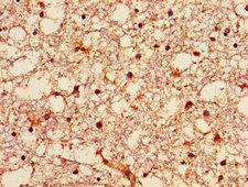 GNPAT / DHAP-AT Antibody - Immunohistochemistry image of paraffin-embedded human brain tissue at a dilution of 1:100