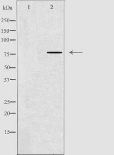 GNPAT / DHAP-AT Antibody - Western blot analysis of extracts of HT29 cells using GNPAT antibody. The lane on the left is treated with the antigen-specific peptide.