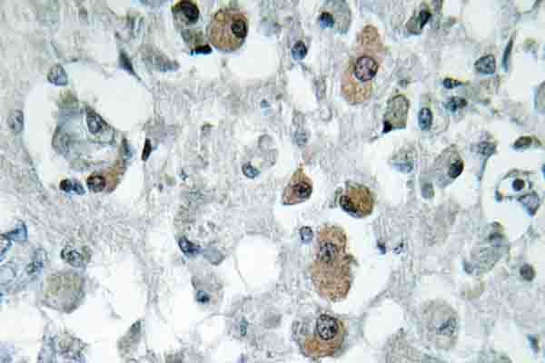 GNPAT / DHAP-AT Antibody - IHC of GNPAT (F365) pAb in paraffin-embedded human brain tissue.