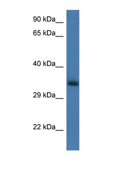 GNPDA1 Antibody - GNPDA1 antibody Western blot of Rat Brain lysate. Antibody concentration 1 ug/ml.  This image was taken for the unconjugated form of this product. Other forms have not been tested.