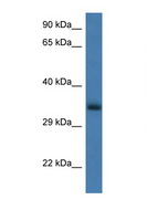 GNPDA1 Antibody - GNPDA1 antibody Western blot of Rat Brain lysate. Antibody concentration 1 ug/ml.  This image was taken for the unconjugated form of this product. Other forms have not been tested.