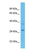 GNPDA1 Antibody - Western blot of GNPDA1 Antibody with human Fetal Kidney lysate.  This image was taken for the unconjugated form of this product. Other forms have not been tested.